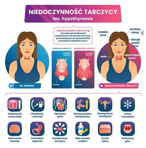infografika_kanalizacni_klinky