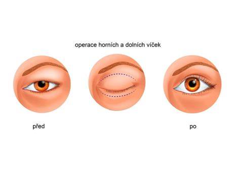 infografika anatomie očních víček